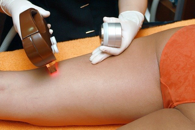 depilacion-laser